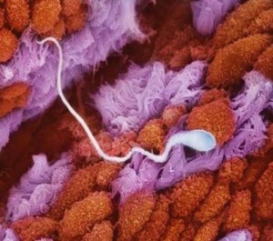 Sperm Fallopian Tube