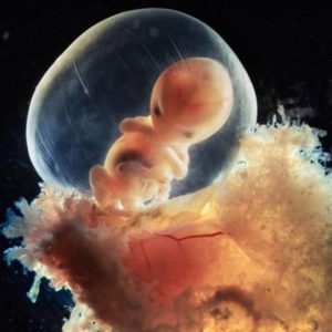 Embryo inside the fetal sac