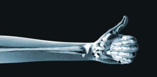 Top 5 Essentials for Having Stronger and Healthy Bones in Humans